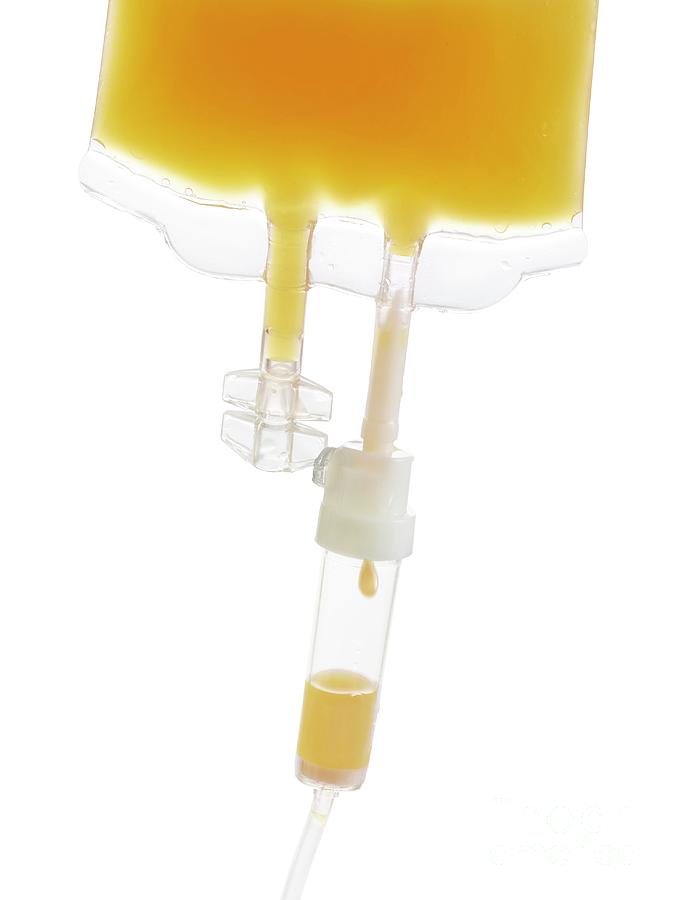 Iv Bag With Orange Juice Photograph by Science Photo Library