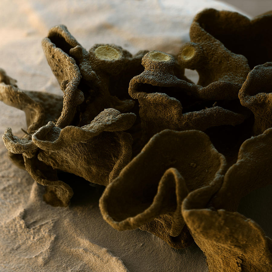 Jelly Lichen Photograph by Meckes/ottawa
