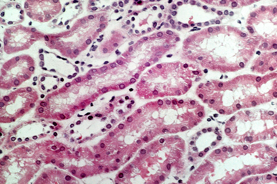 Kidney Cortex, Lm Photograph by Biophoto Associates