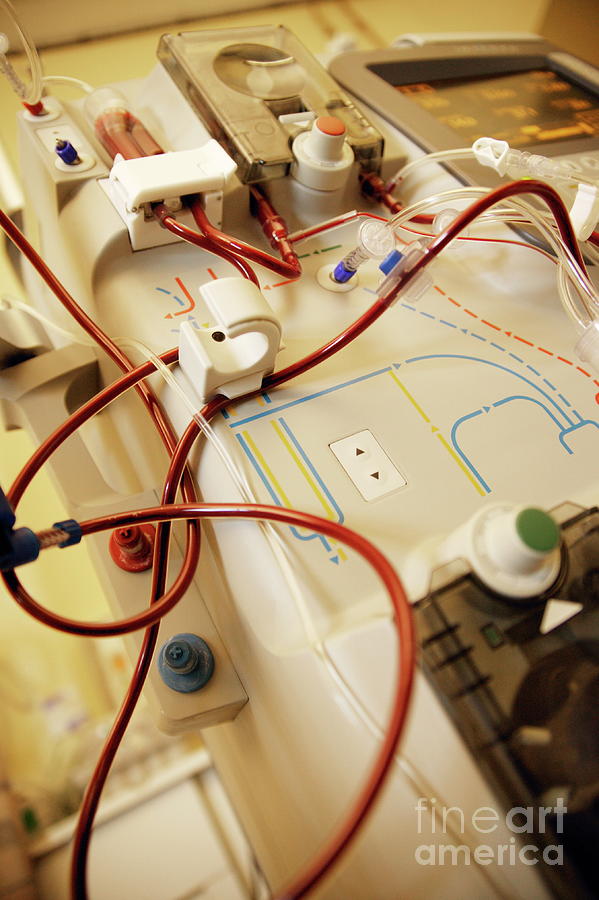 Kidney Dialysis Machine Photograph by Michael Donne/science Photo Library