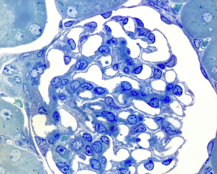 Kidney Glomerulus Photograph by Jose Calvo/science Photo Library
