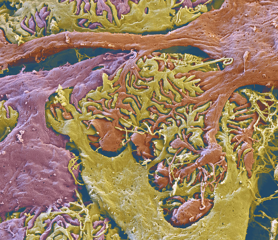 Kidney Glomerulus, Sem Photograph by Oliver Meckes EYE OF SCIENCE