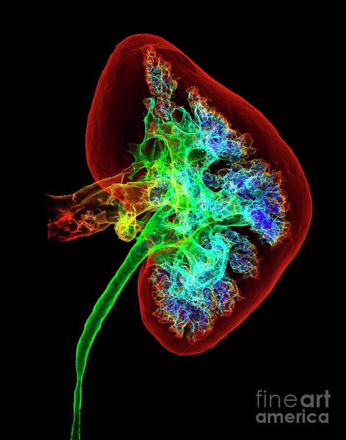 Organ Photograph - Kidney by K H Fung/science Photo Library