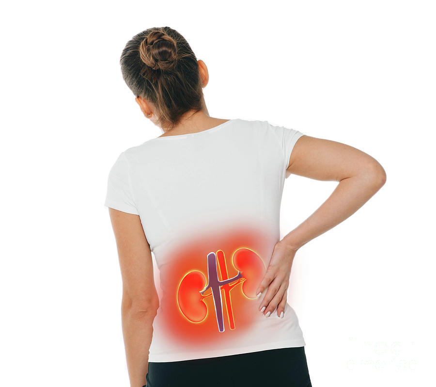 Kidney Pain Photograph by Peakstock / Science Photo Library