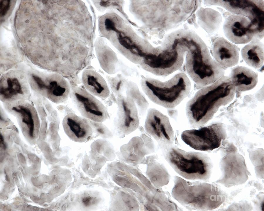 Kidney Proximal Convoluted Tubule Photograph by Jose Calvo/science Photo Library