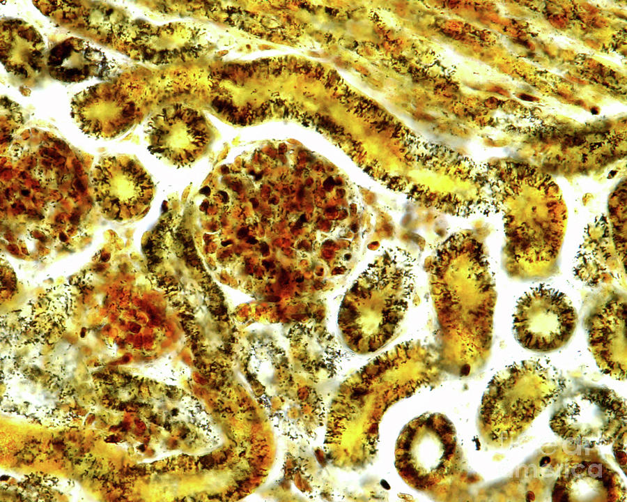 Kidney Stained With Polak?s Silver Method Photograph by Jose Calvo / Science Photo Library