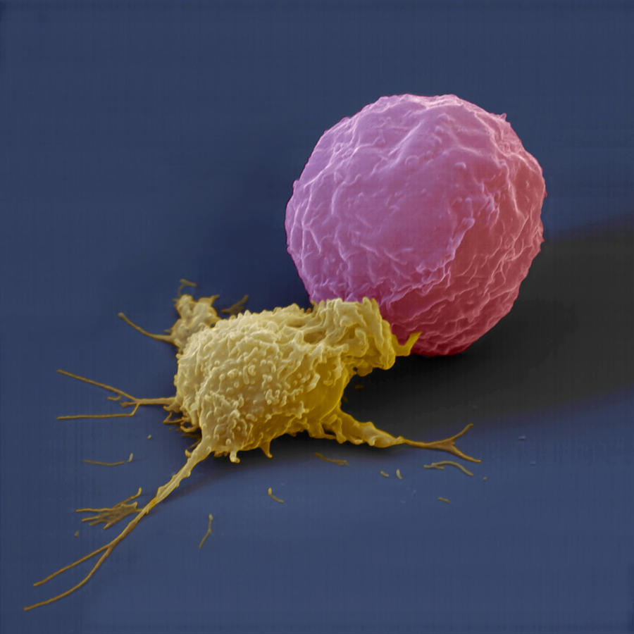 Killer Cell And Cancer Cell Photograph by Meckes/ottawa