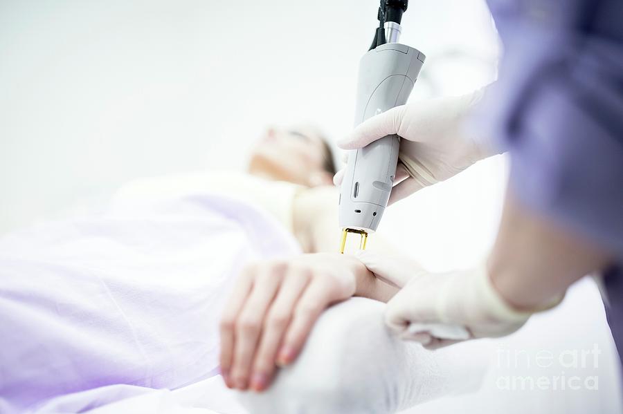 Laser Hair Removal Treatment Photograph by Science Photo Library