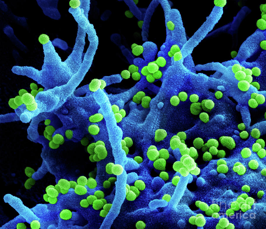 Lassa Virus Budding Photograph by Niaid/national Institutes Of Health ...