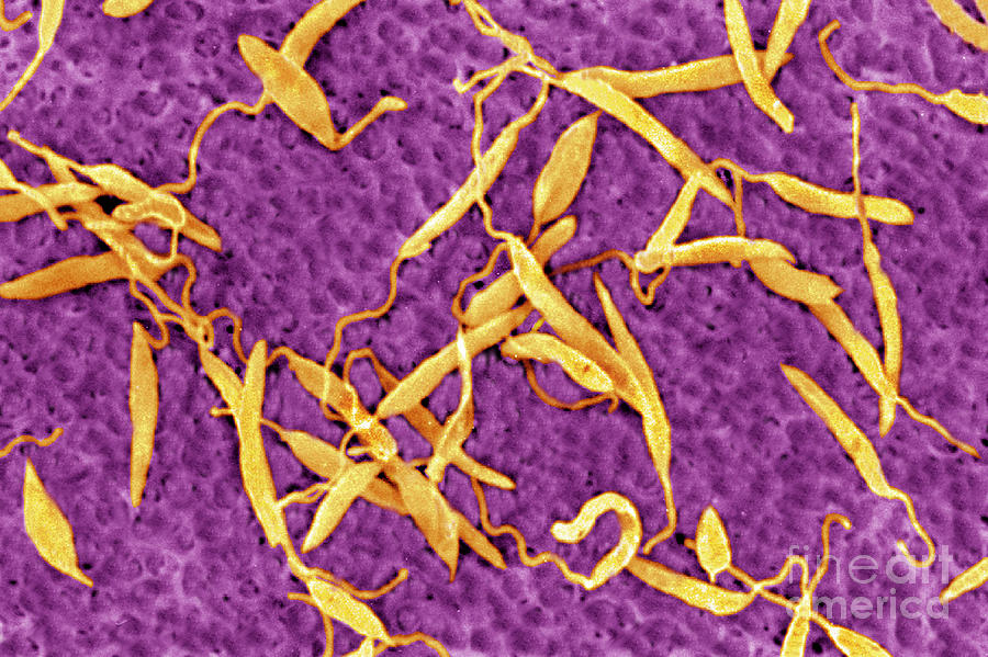 Leishmania Parasitic Protozoa Photograph by Science Photo Library