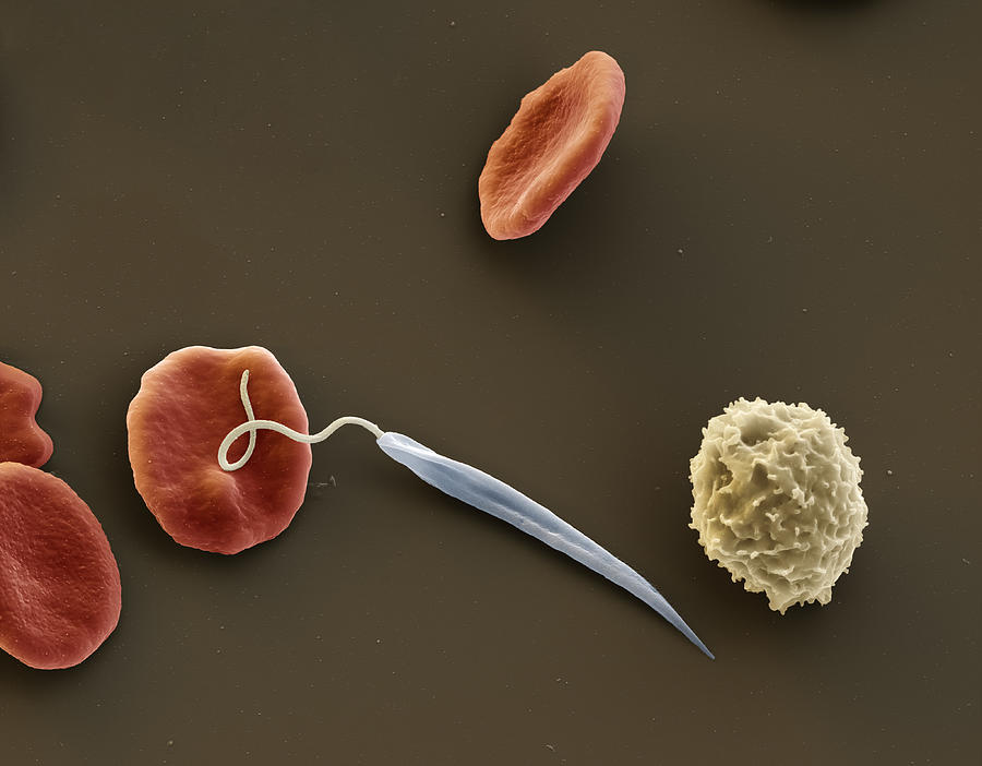 Leishmaniasis And Blood Cells, Sem Photograph by Meckes/ottawa