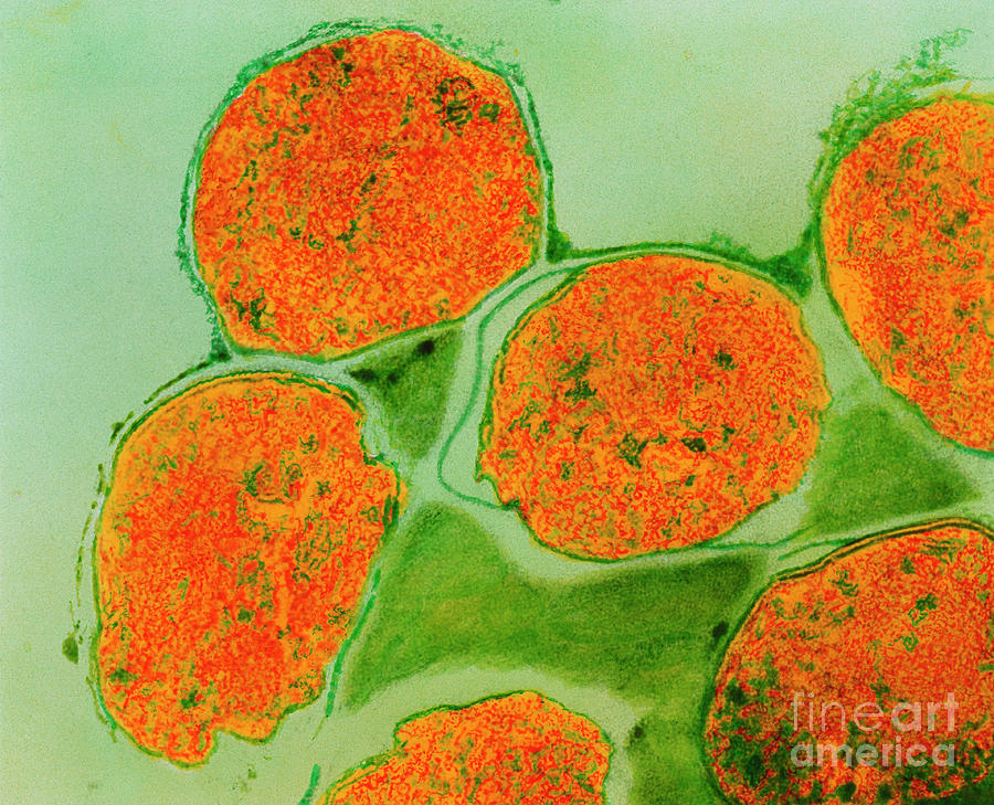 Leprosy Bacteria Tem Photograph By Dr Kari Lounatmaa Science Photo