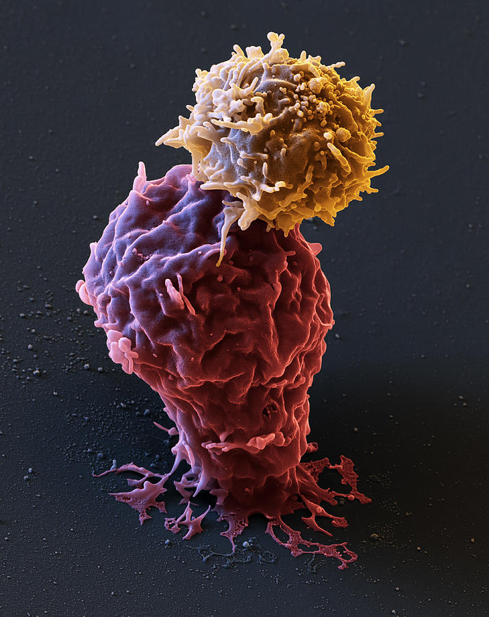 Leukemia Cell With Car T-cell, Sem Photograph by Eye of Science