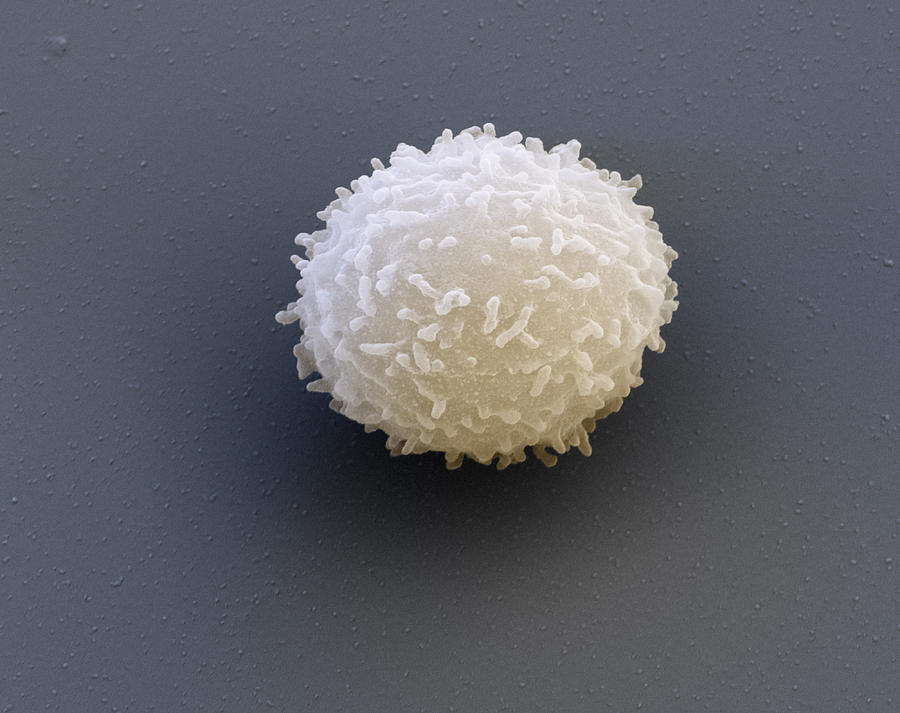 Leukocyte, Sem Photograph by Meckes/ottawa