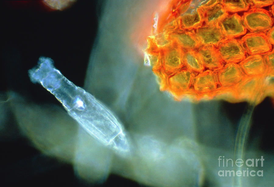 Light Micrograph Of A Bdelloid Rotifer Photograph by John Walsh/science ...