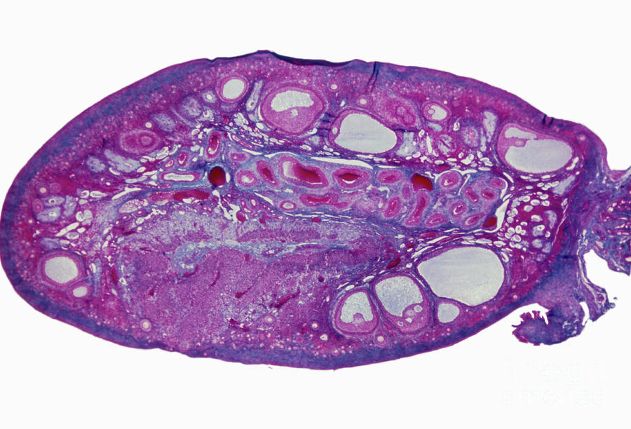Light Micrograph Of A Section Through An Ovary Photograph by Biophoto Associates/science Photo Library