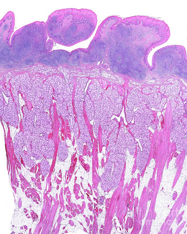 Lingual Tonsil Photograph by Jose Calvo / Science Photo Library