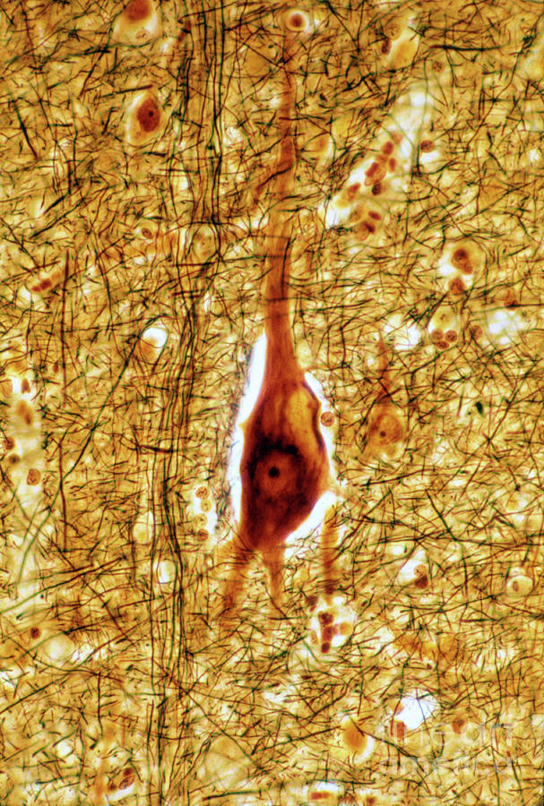 Lipofuscin In Pyramidal Neuron Photograph by Jose Calvo / Science Photo Library