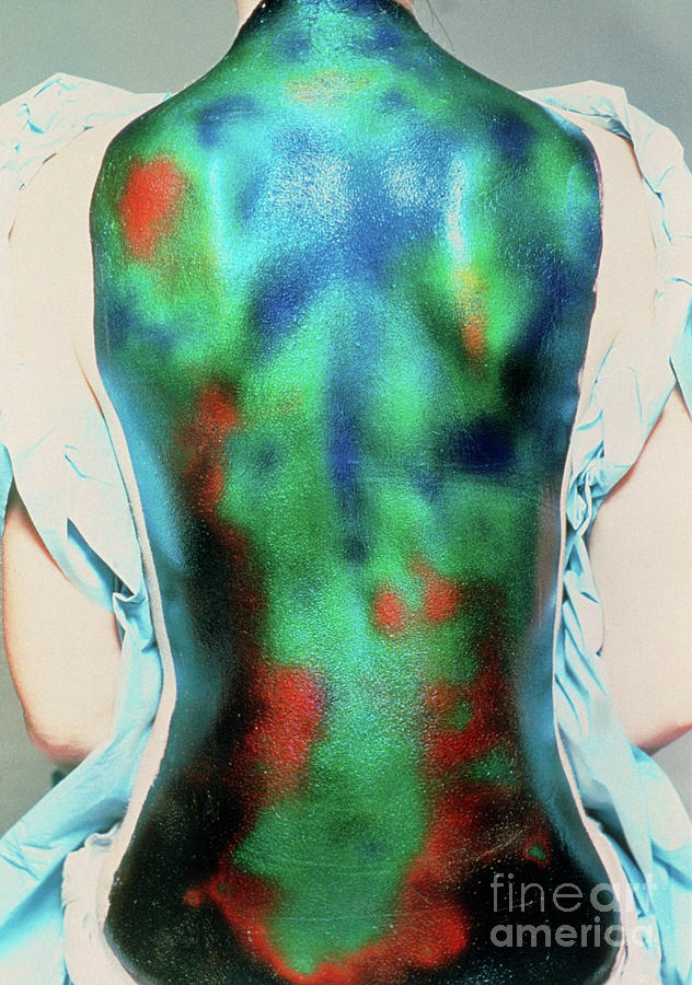 Liquid Crystal Thermography Of A Healthy Back Photograph by Alfred Benjamin/science Photo Library