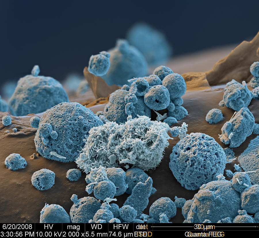 Lithium-ion In Metalloxyd Sem Photograph by Meckes/ottawa