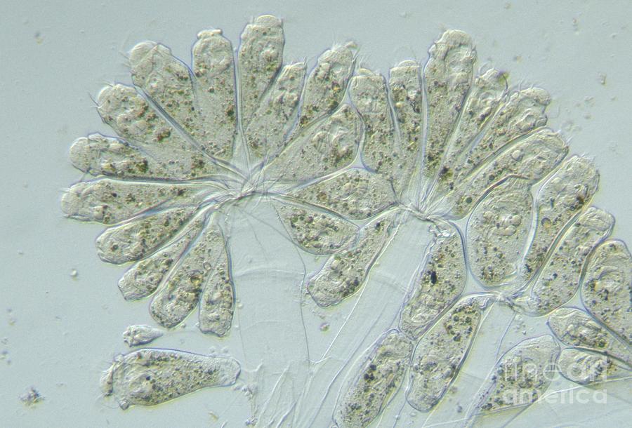 Living Epistylis Protozoa Colony. Lm Photograph by Carolina Biological Supply Company/science Photo Library