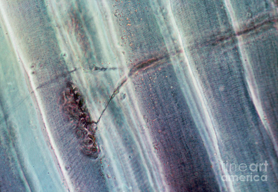 Lm Of A Motor End Plate In Skeletal Muscle Photograph by Science Pictures Limited/science Photo Library