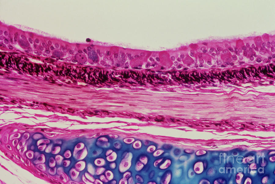 Lm Of A Section Through A Bronchus Of The Lung Photograph by Biophoto ...