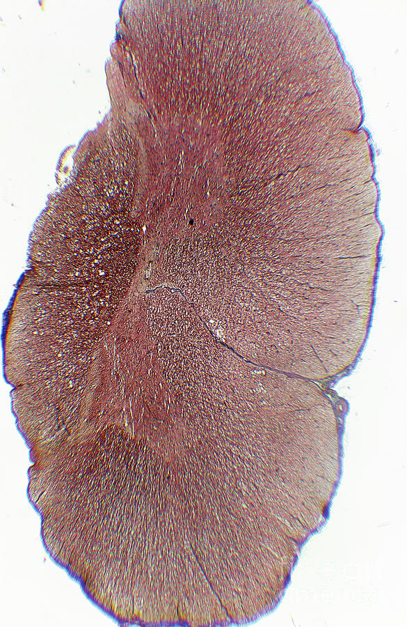 Lm Of A Section Through The Human Spinal Cord Photograph by John