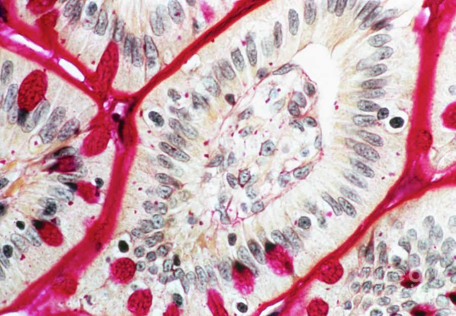 Lm Of An Intestinal Villus In Cross Section Photograph by Biophoto ...