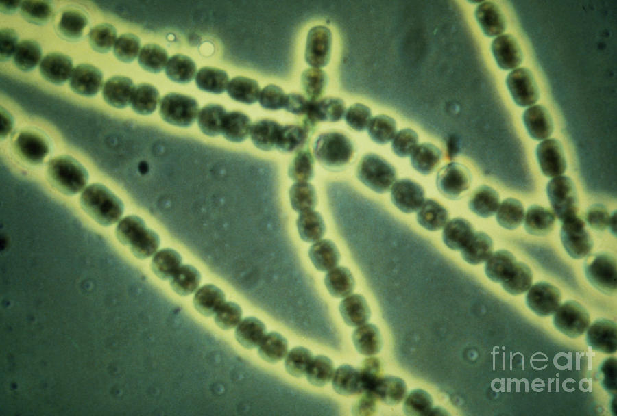 Lm Of Anabaena Sp. Photograph by Prof. David Hall/science Photo Library