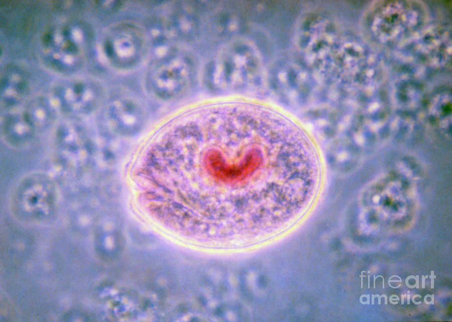 Lm Of Balantidium Coli A Parasitic Protozoan Photograph by Eric Grave ...