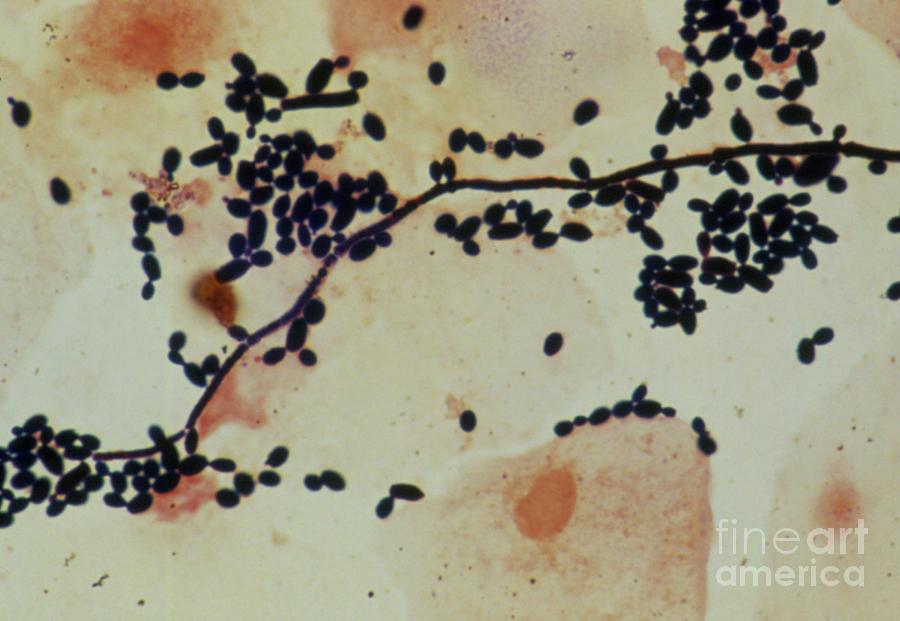 Candida Albicans Photograph - Lm Of Candida Albicans by John Durham/science Photo Library