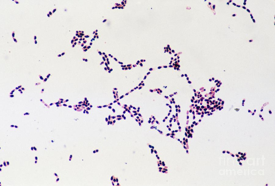Lm Of Colony Of Bacillus Cereus Bacteria Photograph by John Durham/science Photo Library