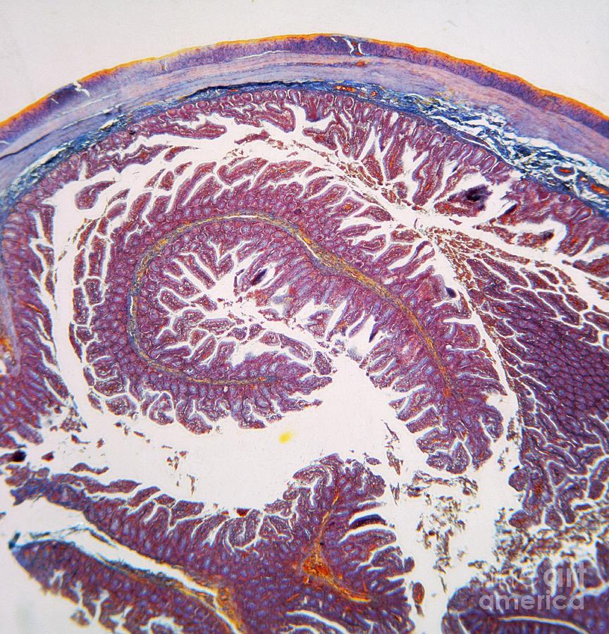 Lm Of Human Duodenum Photograph by John Burbidge/science Photo Library