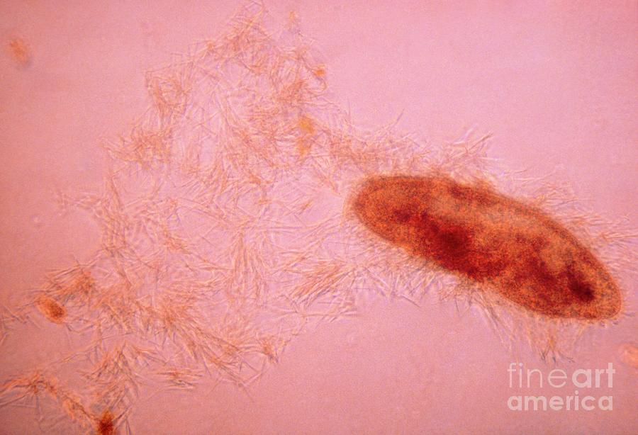 Lm Of Paramecium Caudatum By Eric Gravescience Photo Library 7075