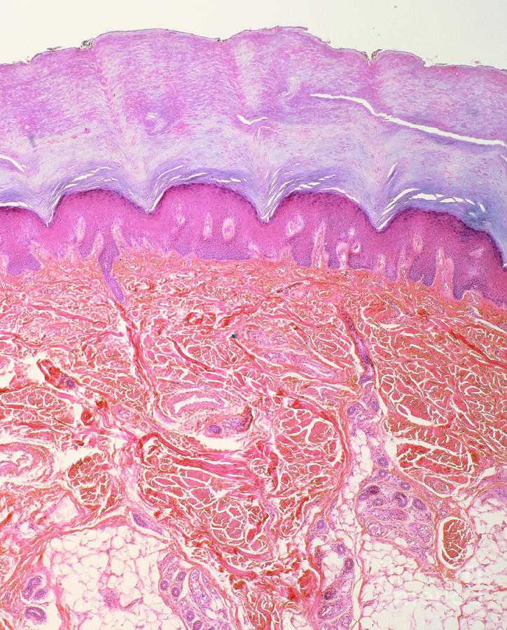 Lm Of Section Of Skin From Human Finger Photograph by Astrid & Hanns ...