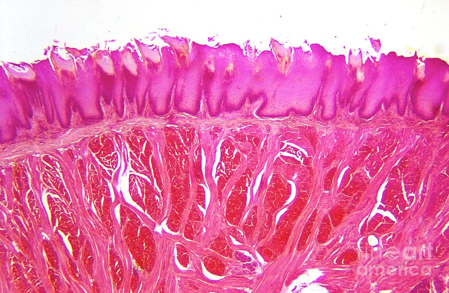 Lm Of Section Through Human Tongue Photograph by John Burbidge/science Photo Library