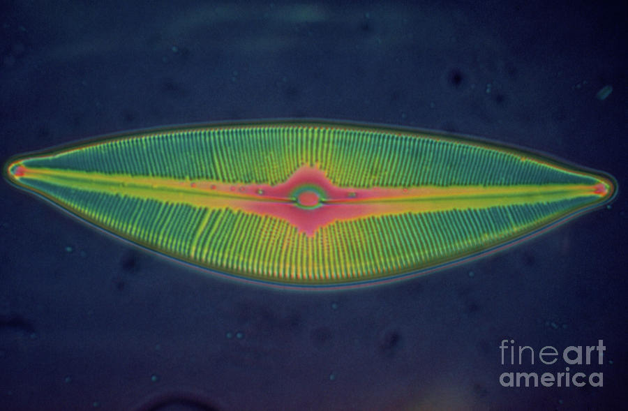 Lm Of The Diatom Alga Cymbella Sp. by Eric Grave/science Photo Library