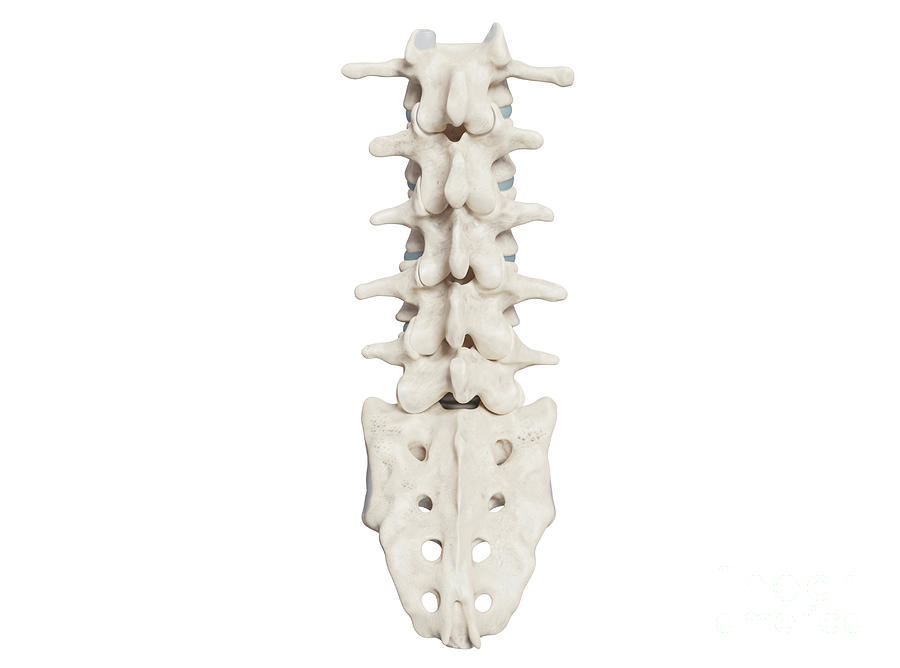 Lumber Spine Photograph by Medical Graphics/michael Hoffmann/science ...