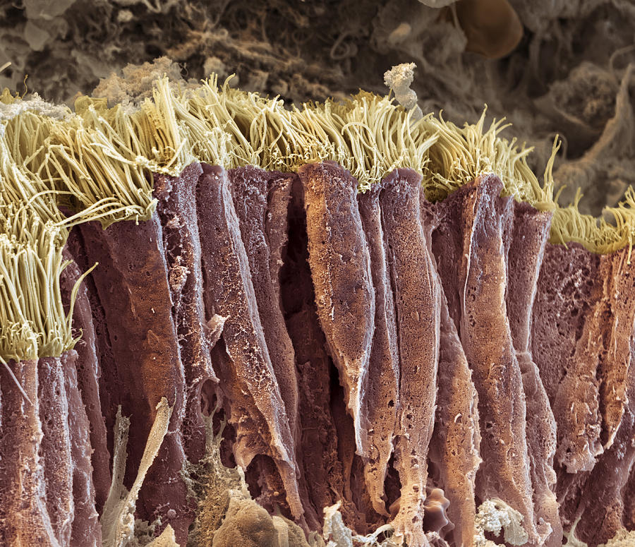Lung Lining Sem Photograph by Oliver Meckes EYE OF SCIENCE