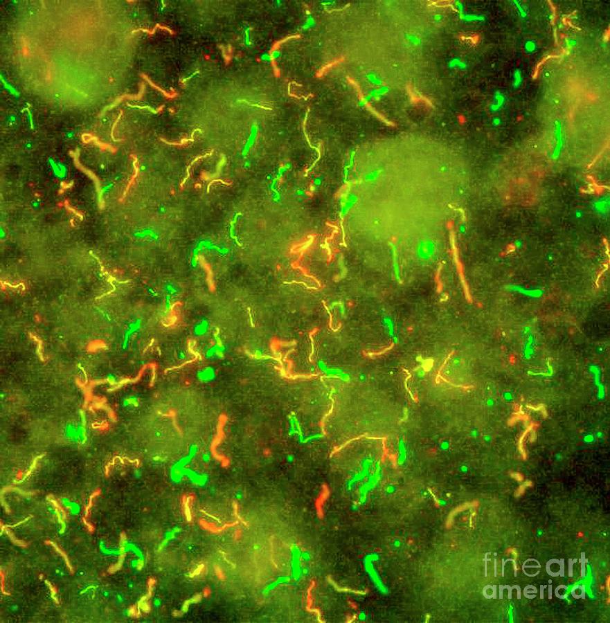 Lyme Disease Bacteria Photograph by National Institute Of Allergy And Infectious Diseases/national Institutes Of Health/science Photo Library