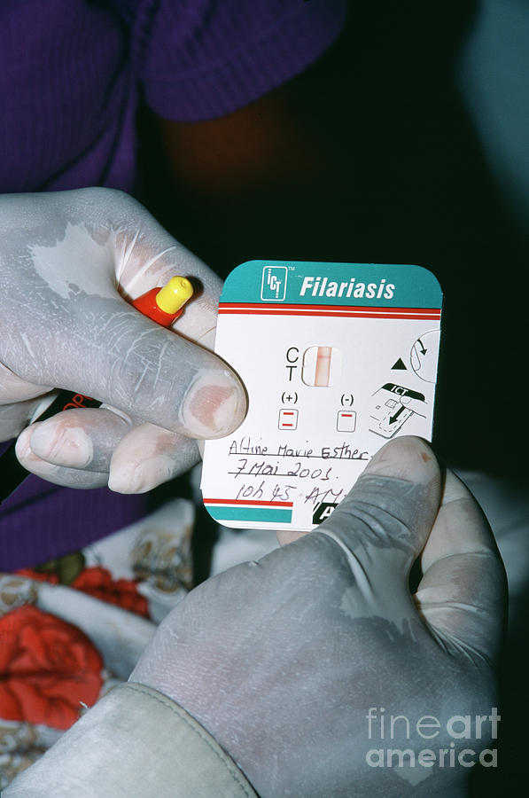 Lymphatic Filariasis Test Photograph by Andy Crump, Tdr, Who/science