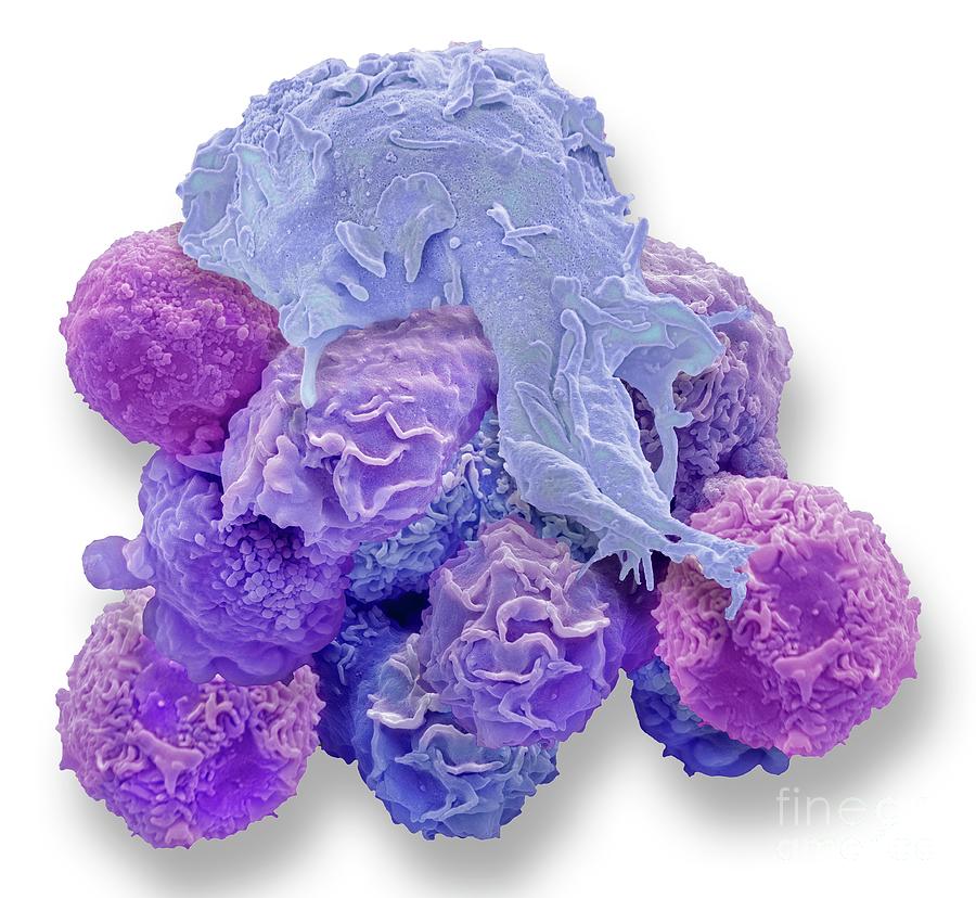 Macrophage And Cancer Cell Photograph by Steve Gschmeissner/science Photo Library