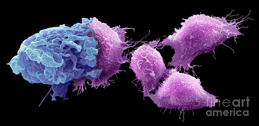Macrophage And Cancer Cells Photograph by Steve Gschmeissner/science Photo Library