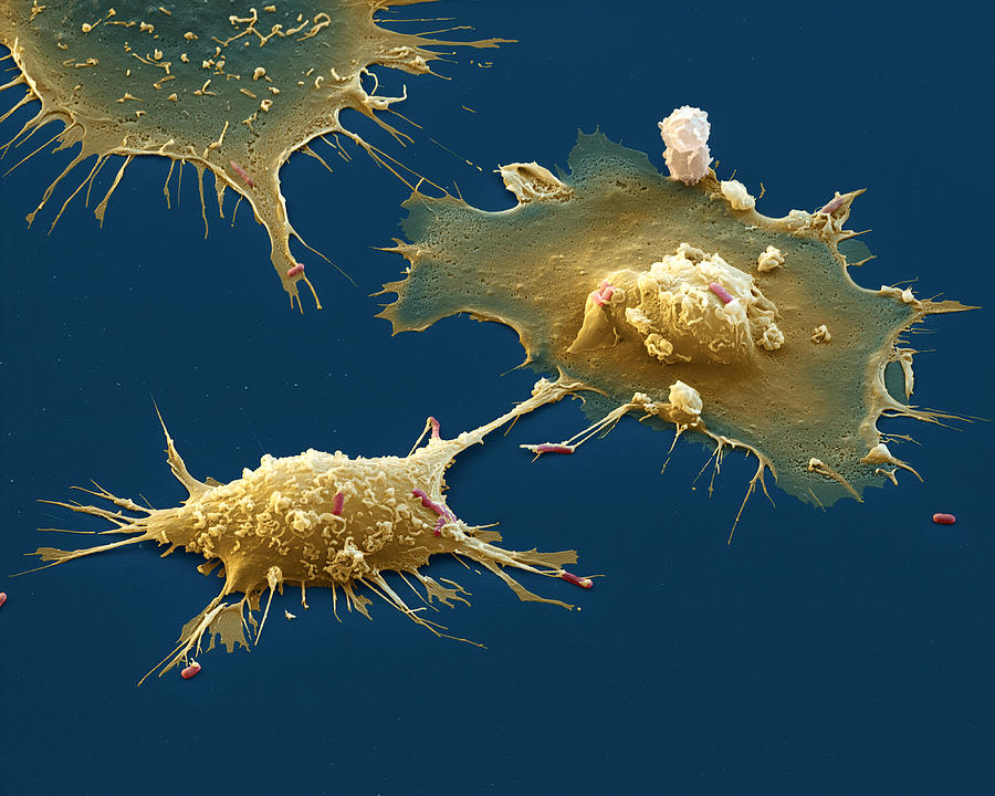 Macrophage And E. Coli Photograph by Eye of Science