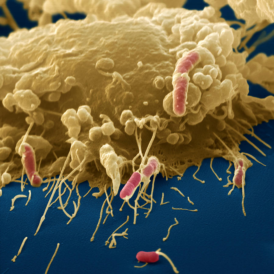 Macrophage And E. Coli Photograph by Oliver Meckes EYE OF SCIENCE