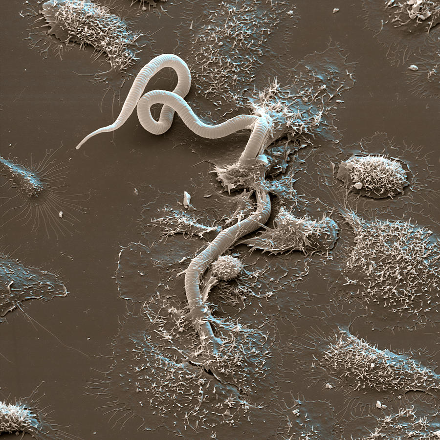 Macrophage And Microfilaria Photograph by Meckes/ottawa