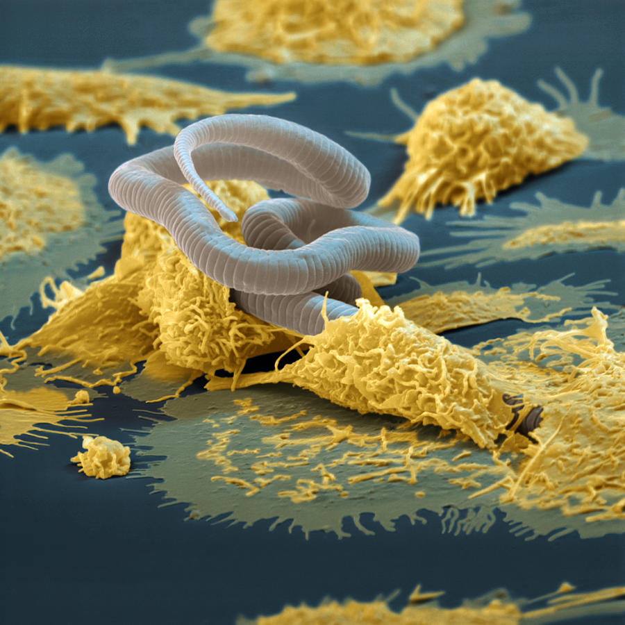Macrophage And Microfilaria Photograph by Oliver Meckes EYE OF SCIENCE
