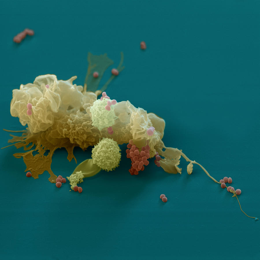 Macrophage And Staphylococcus Photograph by Meckes/ottawa