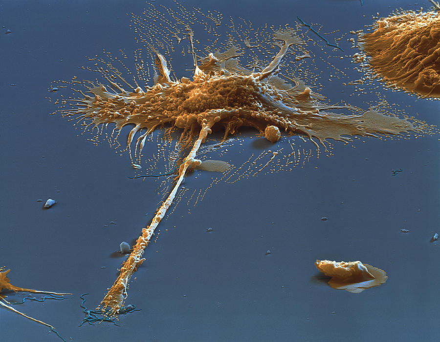 Macrophage Engulfing Bacteria Photograph by Meckes/ottawa